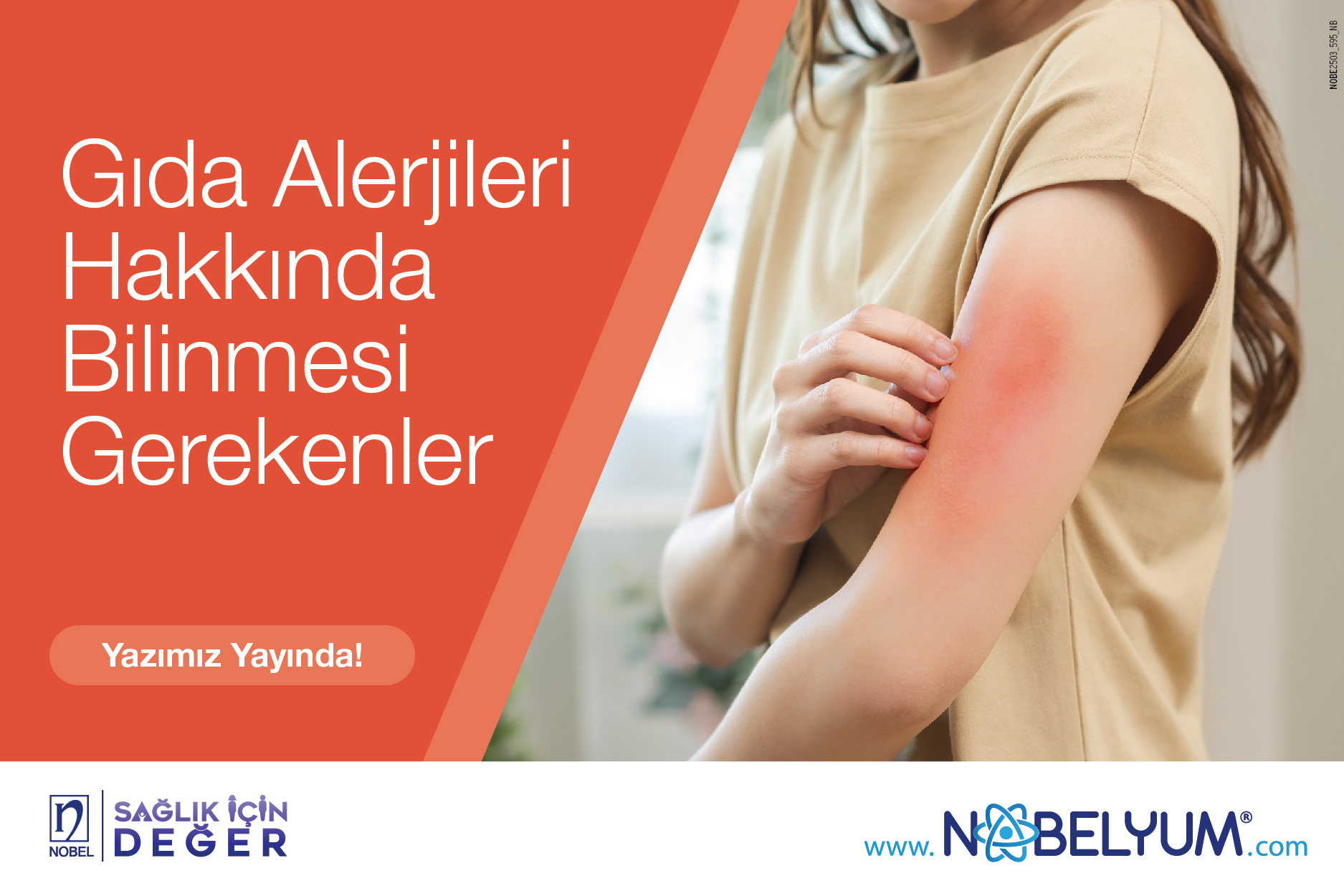 gidaalerjileri-thumbnail